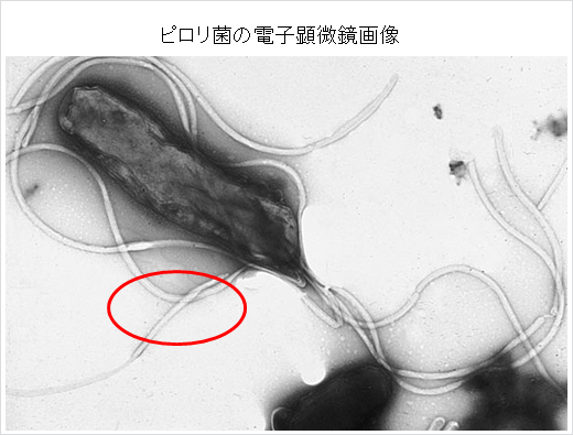 ピロリ菌　画像